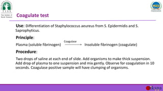 Use: Differentiation of Staphylococcus aeureus from S. Epidermidis and S.
Saprophyticus.
Principle:
Plasma (soluble fibrin...