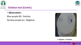  Observation :
Blue purple (R) : Positive
No blue purple (L) : Negative
Oxidase test (Contd.)
L: Negative R: Positive
Dr....