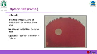  Result:
Positive (image): Zone of
inhibition > 14 mm for 6mm
disk
No zone of inhibition: Negative
test
Equivocal : Zone ...