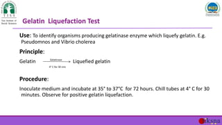 Use: To identify organisms producing gelatinase enzyme which liquefy gelatin. E.g.
Pseudomnos and Vibrio cholerea
Principl...