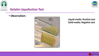  Observation :
Gelatin Liquefaction Test
Liquid media: Positive test
Solid media: Negative test
 