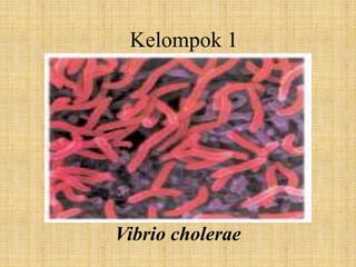 Vibrio cholerae
Kelompok 1
 