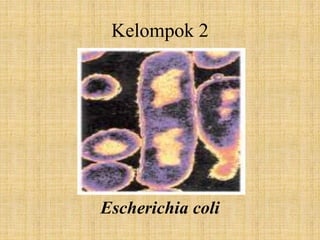 Kelompok 2
Escherichia coli
 