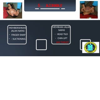 5. AIRWAY
MEMBERSIHKAN
JALAN NAFAS
- FINGER SWAP
- - SUCTIONING
MEMBUKA JALAN
NAFAS
- HEAD TILD
- CHIN LIFT
- JAW THRUST
 