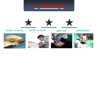 6. BREATHING
MOUTH TO MOUTH MOUTH TO MASK AMBU BAG JACKSENREES
 