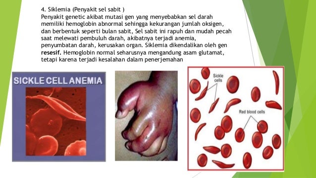 Gangguan Sistem Peredaran Darah