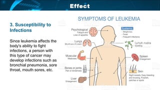 03
02
01
05
04
3. Susceptibility to
Infections
Since leukemia affects the
body's ability to fight
infections, a person with
this type of cancer may
develop infections such as
bronchial pneumonia, sore
throat, mouth sores, etc.
Effect
 