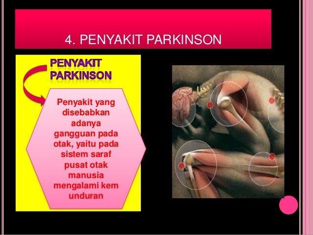 Kelainan dan penyakit pada sistem saraf