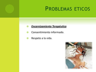 P ROBLEMAS         ETICOS


   Encarnizamiento Terapéutico

   Consentimiento informado.

   Respeto a la vida.
 