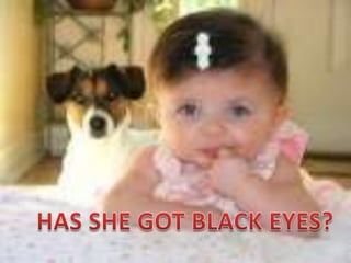 HAS SHE GOT BLACK EYES?