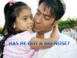 HAS HE GOT A BIG NOSE?