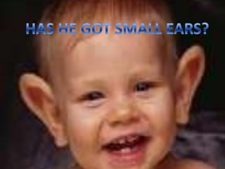 HAS HE GOT SMALL EARS?