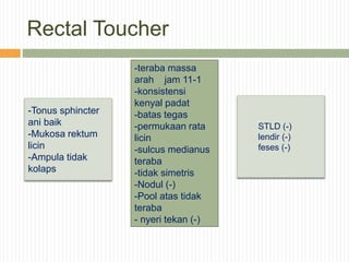 Rectal Toucher
-Tonus sphincter
ani baik
-Mukosa rektum
licin
-Ampula tidak
kolaps
-teraba massa
arah jam 11-1
-konsistensi
kenyal padat
-batas tegas
-permukaan rata
licin
-sulcus medianus
teraba
-tidak simetris
-Nodul (-)
-Pool atas tidak
teraba
- nyeri tekan (-)
STLD (-)
lendir (-)
feses (-)
 
