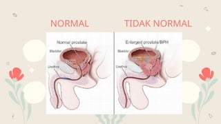 NORMAL TIDAK NORMAL
You can describe the
topic of the section
here
You can describe the
topic of the section
here
OUR
CENTER KEY NUMBERS
PATIENT CARE
ACCOMPLISHM
ENTS
 