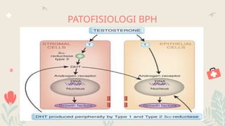 01
You can describe the topic
of the section here
03
You can describe the topic
of the section here
02
You can describe the topic
of the section here
04
You can describe the topic
of the section here
PATOFISIOLOGI BPH
OUR CENTER KEY NUMBERS
PATIENT CARE
HEALTH AREAS
06
You can describe the topic
of the section here
05
You can describe the topic
of the section here
INSTITUTION
MEDICAL STAFF
 