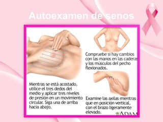 Autoexamen de senos
 