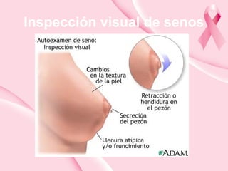 Inspección visual de senos
 