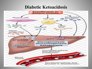 Diabetic Ketoacidosis
 