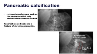Pancreatic calcification
 retroperitoneal organs such as
the pancreas which only
become visible when calcified.
Pancreatic calcification is a
feature of chronic pancreatitis.
 