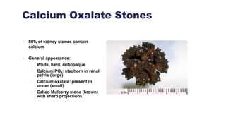 Calcium Oxalate Stones
 80% of kidney stones contain
calcium
 General appearance:
1. White, hard, radiopaque
2. Calcium PO4: staghorn in renal
pelvis (large)
3. Calcium oxalate: present in
ureter (small)
4. Called Mulberry stone (brown)
with sharp projections.
 