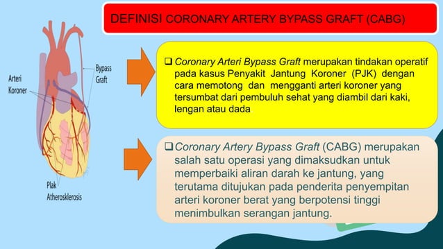 TINDAKAN KOROANGIOGRAFI POST OPERASI CABG | PPTX