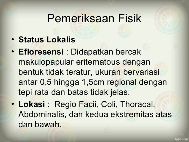 Ppt campak