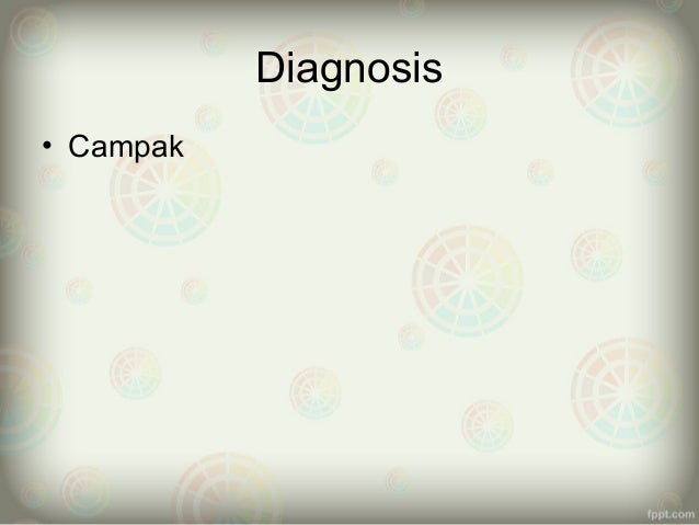 Ppt campak