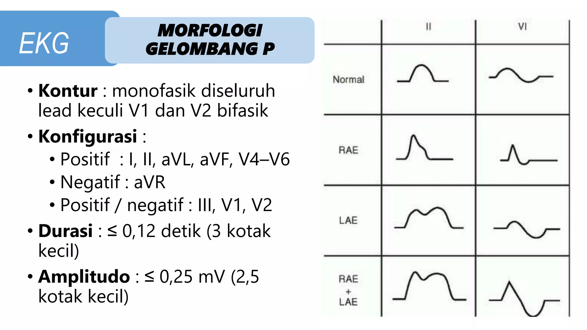 PPT CARDIO - EKG.pptx