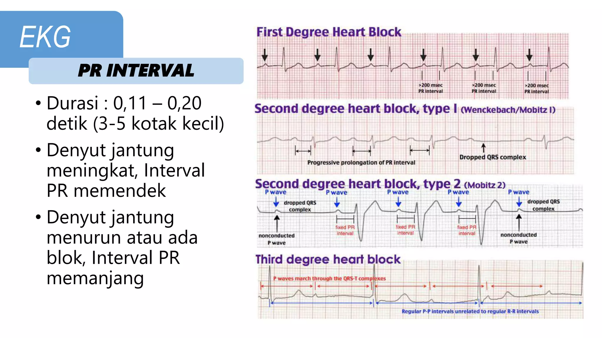 PPT CARDIO - EKG.pptx