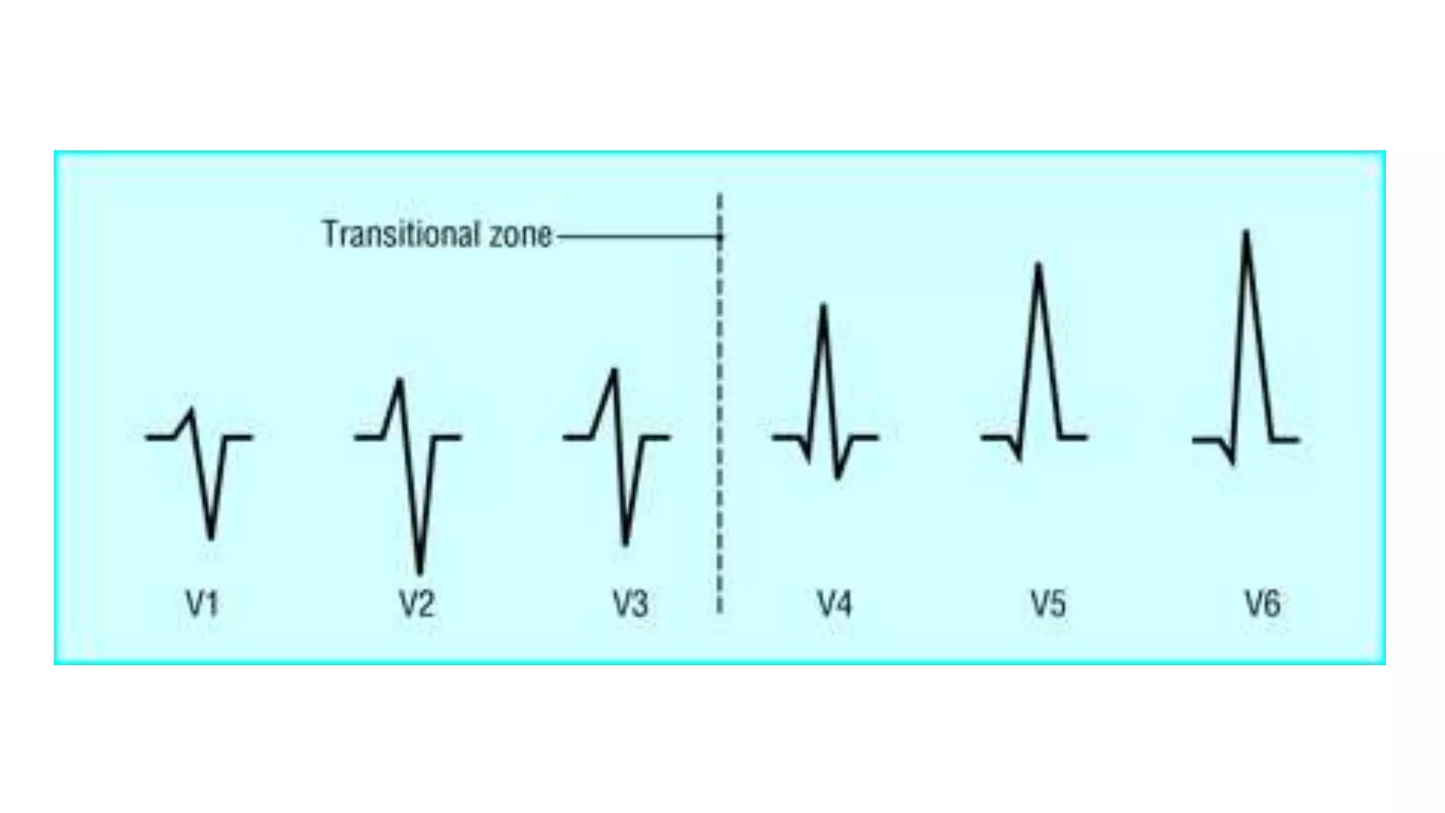 PPT CARDIO - EKG.pptx