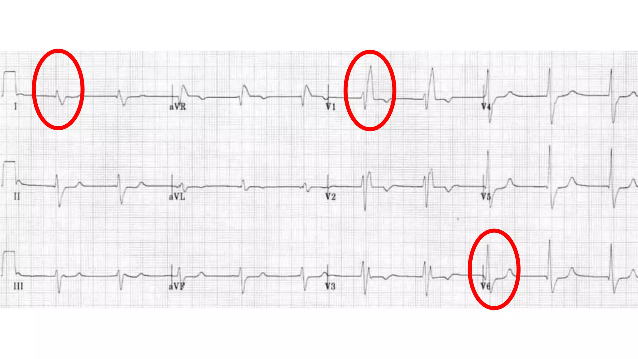 PPT CARDIO - EKG.pptx