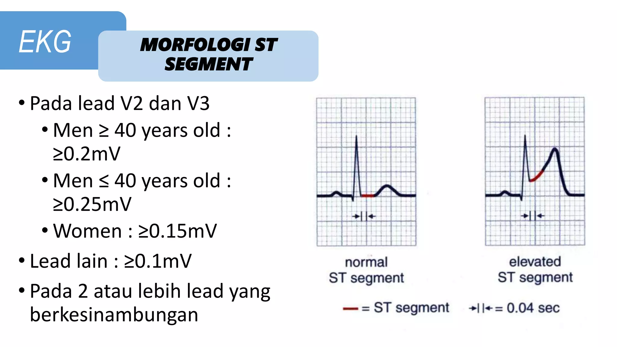 PPT CARDIO - EKG.pptx