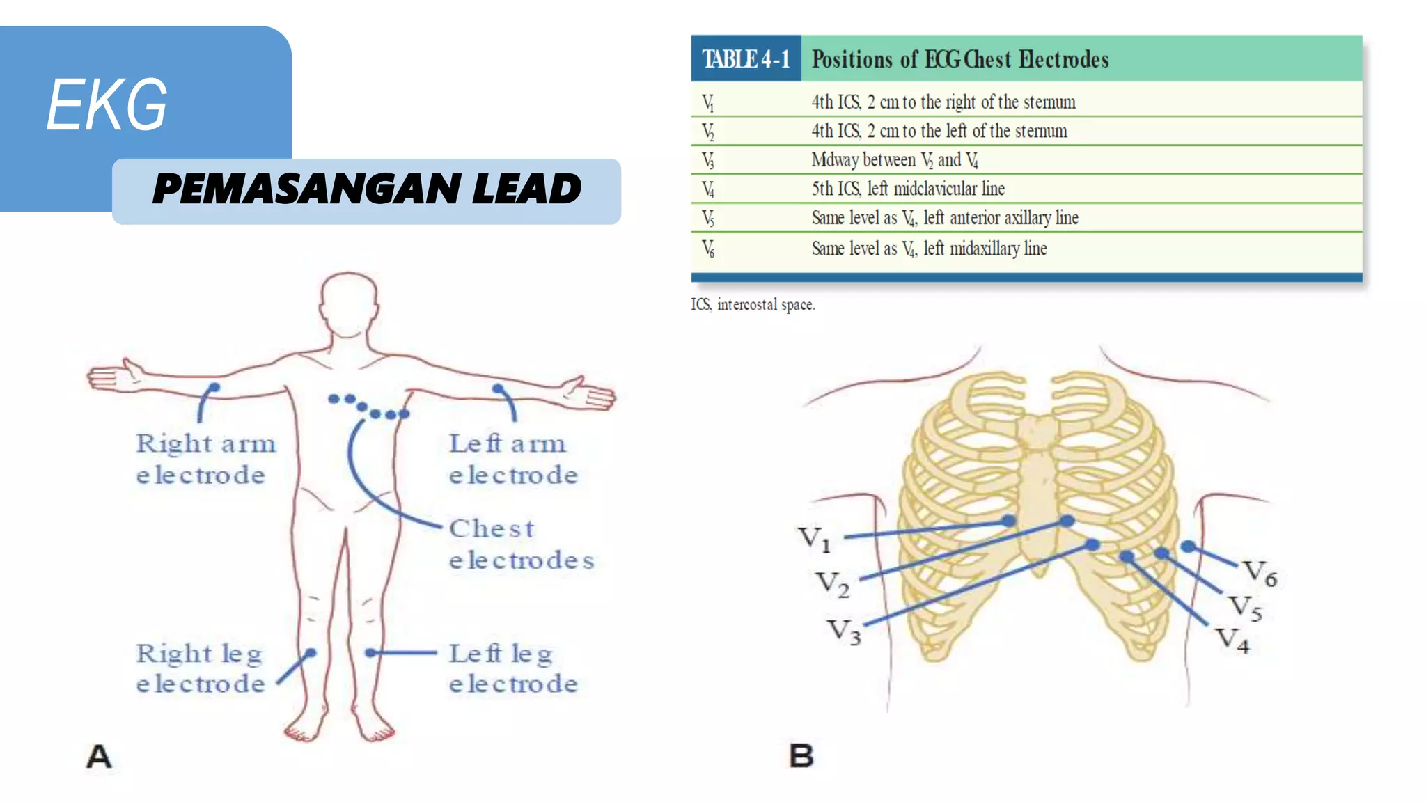 PPT CARDIO - EKG.pptx