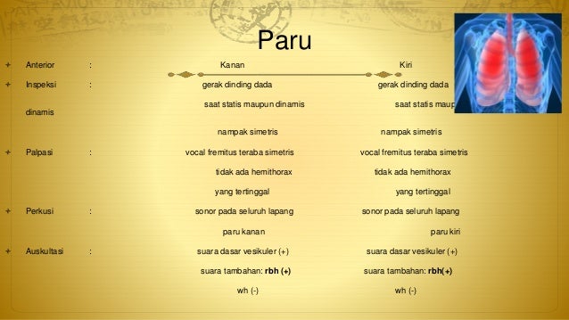 Case Thyroid Heart Disease