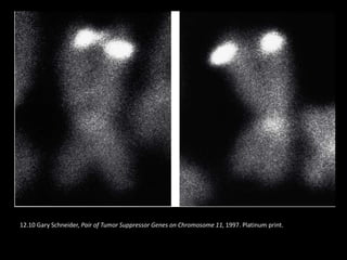 12.10 Gary Schneider, Pair of Tumor Suppressor Genes on Chromosome 11, 1997. Platinum print.
 