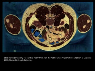 12.11 Stanford University, The Stanford Visible Male, from the Visible Human Project™, National Library of Medicine,
1990s. Stanford University California.
 