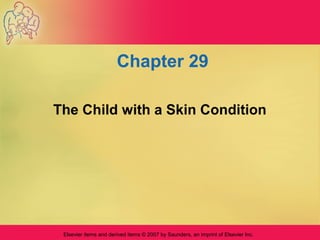 Elsevier items and derived items © 2007 by Saunders, an imprint of Elsevier Inc.
Chapter 29
The Child with a Skin Condition
 