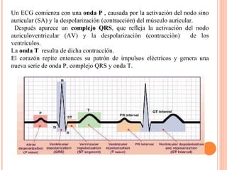 Un ECG comienza con una  onda P  , causada por la activación del nodo sino auricular (SA) y la despolarización (contracción) del músculo auricular. Después aparece un  complejo QRS , que refleja la activación del nodo auriculoventricular (AV) y la despolarización (contracción)  de los ventrículos.  La  onda T  resulta de dicha contracción.  El corazón repite entonces su patrón de impulsos eléctricos y genera una nueva serie de onda P, complejo QRS y onda T.  