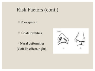 Risk Factors (cont.)
◦Poor speech
◦Lip deformities
◦Nasal deformities
(cleft lip effect, right)
 