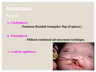 Management:
Surgical :
a. Cheiloplasty-
-Tennison-Randall triangular flap (Ezplasty)
b. Palatoplasty-
- Millard rotational advancement technique.
c. Latham appliance.
 