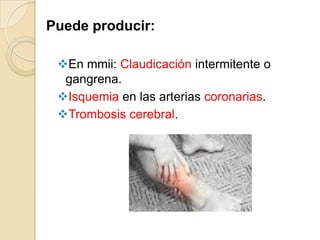 Puede producir:
En mmii: Claudicación intermitente o
gangrena.
Isquemia en las arterias coronarias.
Trombosis cerebral.
 