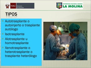 Autotrasplante o autoinjerto o trasplante autólogo  Isotrasplante Alotrasplante u homotrasplante Xenotrasplante o heterotrasplante o trasplante heterólogo 