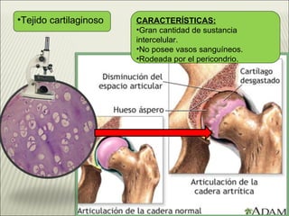 Tejido cartilaginoso CARACTERÍSTICAS: Gran cantidad de sustancia intercelular. No posee vasos sanguíneos. Rodeada por el pericondrio.   