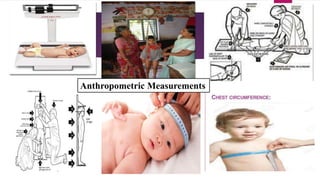 Anthropometric Measurements
 