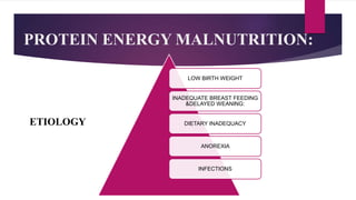 PROTEIN ENERGY MALNUTRITION:
LOW BIRTH WEIGHT
INADEQUATE BREAST FEEDING
&DELAYED WEANING:
DIETARY INADEQUACY
ANOREXIA
INFECTIONS
ETIOLOGY
 