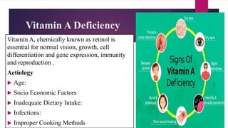 Vitamin A Deficiency
Vitamin A, chemically known as retinol is
essential for normal vision, growth, cell
differentiation and gene expression, immunity
and reproduction .
Aetiology
 Age:
 Socio Economic Factors
 Inadequate Dietary Intake:
 Infections:
 Improper Cooking Methods
 