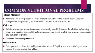 COMMON NUTRITIONAL PROBLEMS
Macro Minerals
 Macrominerals are present at levels more than 0.05% in the human body. Calcium,
Phosphorus, Magnesium, Sodium and Potassium are macrominerals.
Calcium
 Calcium is a mineral that is required continually at all life stages. In addition to building
bones and keeping them solid, calcium enables our blood to clot, our muscles to contract,
and our heart to pump.
 Calcium Deficiency Disease
Osteoporosis
 Osteoporosis is characterized by excessive skeletal fragility and susceptibility to low-
trauma fracture among the elderly.
 
