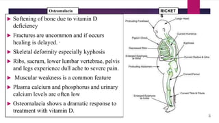  Softening of bone due to vitamin D
deficiency
 Fractures are uncommon and if occurs
healing is delayed. ·
 Skeletal deformity especially kyphosis
 Ribs, sacrum, lower lumbar vertebrae, pelvis
and legs experience dull ache to severe pain.
 Muscular weakness is a common feature
 Plasma calcium and phosphorus and urinary
calcium levels are often low
 Osteomalacia shows a dramatic response to
treatment with vitamin D.
RICKET
S
Osteomalacia
 