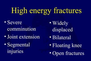 High energy fractures
• Severe
comminution
• Joint extension
• Segmental
injuries
• Widely
displaced
• Bilateral
• Floating knee
• Open fractures
 
