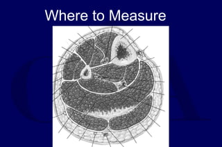 Where to Measure
 